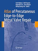 Télécharger le livre :  Atlas of Percutaneous Edge-to-Edge Mitral Valve Repair
