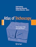 Télécharger le livre :  Atlas of Trichoscopy