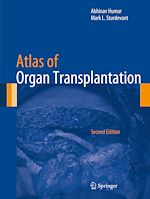 Télécharger le livre :  Atlas of Organ Transplantation
