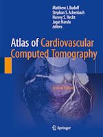 Télécharger le livre :  Atlas of Cardiovascular Computed Tomography
