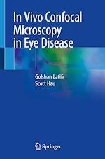Télécharger le livre :  In Vivo Confocal Microscopy in Eye Disease
