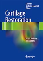 Télécharger le livre :  Cartilage Restoration