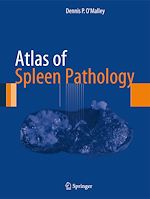 Télécharger le livre :  Atlas of Spleen Pathology