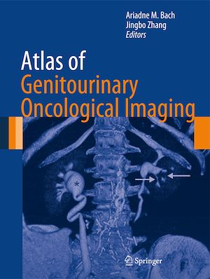 Téléchargez le livre :  Atlas of Genitourinary Oncological Imaging