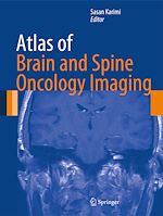 Télécharger le livre :  Atlas of Brain and Spine Oncology Imaging