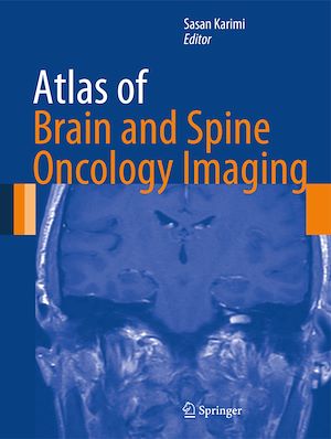 Téléchargez le livre :  Atlas of Brain and Spine Oncology Imaging