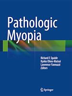 Télécharger le livre :  Pathologic Myopia