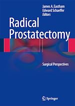 Télécharger le livre :  Radical Prostatectomy
