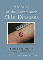 Télécharger le livre :  An Atlas of the Commoner Skin Diseases