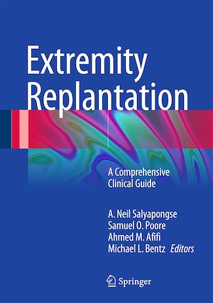 Téléchargez le livre :  Extremity Replantation
