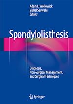 Télécharger le livre :  Spondylolisthesis