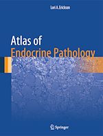 Télécharger le livre :  Atlas of Endocrine Pathology