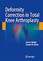 Télécharger le livre :  Deformity Correction in Total Knee Arthroplasty