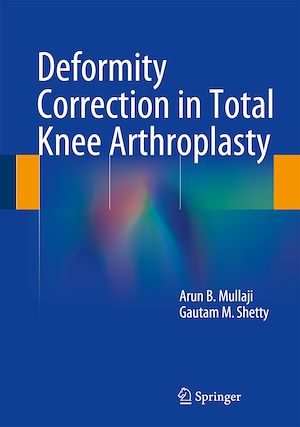 Téléchargez le livre :  Deformity Correction in Total Knee Arthroplasty