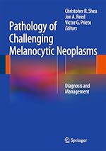 Télécharger le livre :  Pathology of Challenging Melanocytic Neoplasms