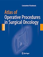 Télécharger le livre :  Atlas of Operative Procedures in Surgical Oncology
