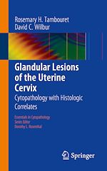 Télécharger le livre :  Glandular Lesions of the Uterine Cervix