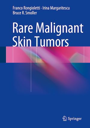 Téléchargez le livre :  Rare Malignant Skin Tumors