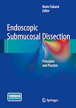 Télécharger le livre :  Endoscopic Submucosal Dissection
