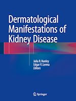 Télécharger le livre :  Dermatological Manifestations of Kidney Disease