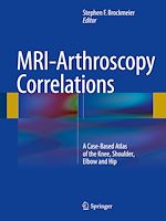 Télécharger le livre :  MRI-Arthroscopy Correlations