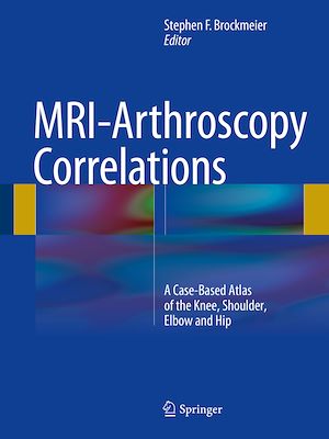 Téléchargez le livre :  MRI-Arthroscopy Correlations