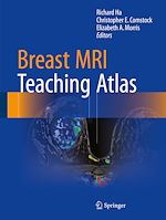 Télécharger le livre :  Breast MRI Teaching Atlas