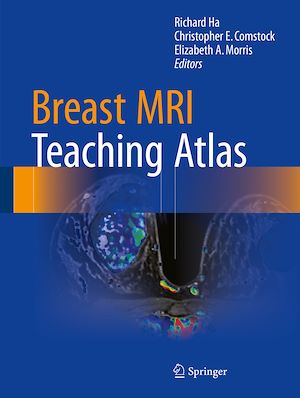 Téléchargez le livre :  Breast MRI Teaching Atlas