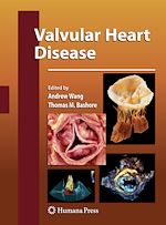 Télécharger le livre :  Valvular Heart Disease