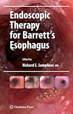 Télécharger le livre :  Endoscopic Therapy for Barrett's Esophagus
