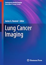 Télécharger le livre :  Lung Cancer Imaging