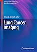 Télécharger le livre :  Lung Cancer Imaging