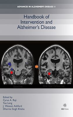 Télécharger le livre :  Handbook of Intervention and Alzheimer's Disease