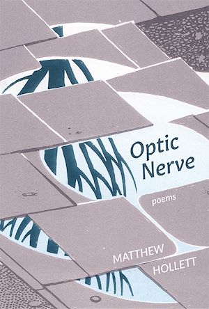 Download the eBook: Optic Nerve