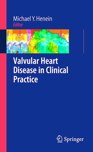 Téléchargez le livre :  Valvular Heart Disease in Clinical Practice