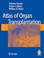 Télécharger le livre :  Atlas of Organ Transplantation