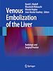 Télécharger le livre :  Venous Embolization of the Liver