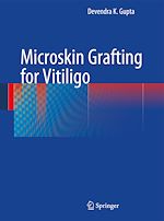 Télécharger le livre :  Microskin Grafting for Vitiligo
