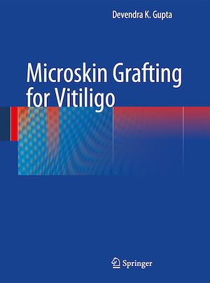 Téléchargez le livre :  Microskin Grafting for Vitiligo