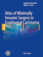 Télécharger le livre :  Atlas of Minimally Invasive Surgery in Esophageal Carcinoma