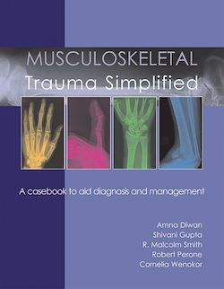 Télécharger le livre :  Musculoskeletal Trauma Simplified