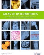 Télécharger le livre :  Atlas of Osteoarthritis