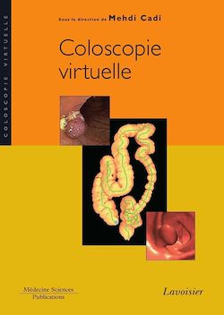 Télécharger le livre :  Coloscopie virtuelle