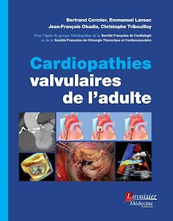 Télécharger le livre :  Cardiopathies valvulaires de l'adulte