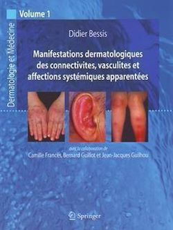 Télécharger le livre :  Manifestations dermatologiques des connectivites, vasculites et affections systématiques...