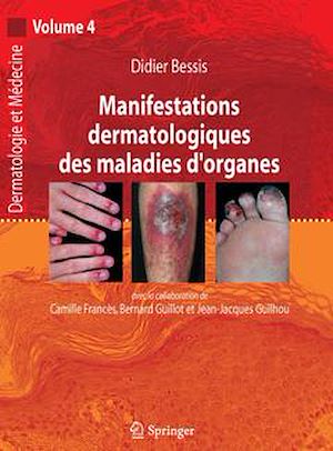 Téléchargez le livre :  Manifestations dermatologiques des maladies d'organes (Dermatologie et médecine, volume 4)
