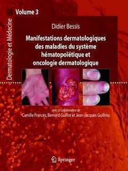 Télécharger le livre :  Manifestations dermatologiques des maladies du système hématopoïétiques et oncologie...