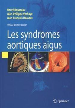 Télécharger le livre :  Syndromes aortiques aigus