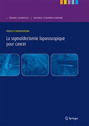 Téléchargez le livre :  La sigmoïdectomie laparoscopique pour cancer