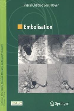 Télécharger le livre :  Embolisation